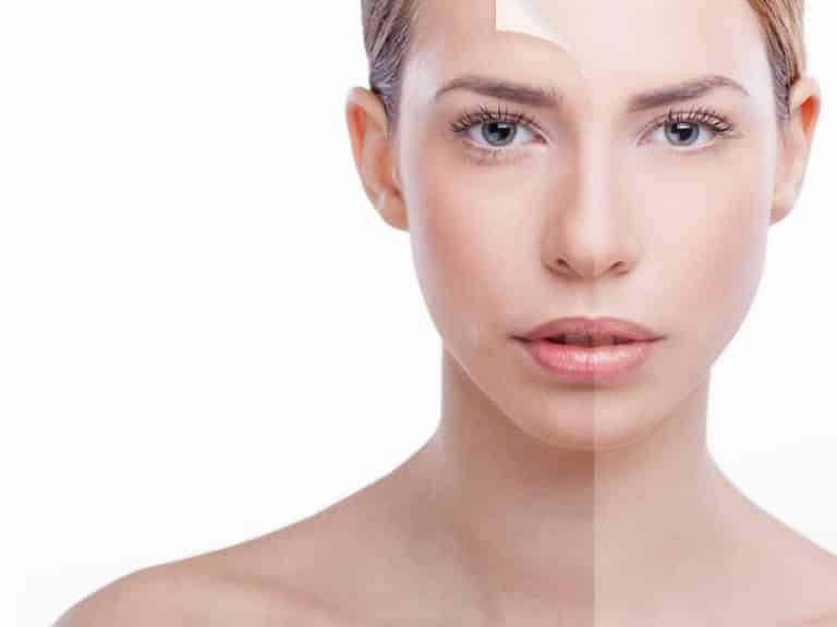 7 Ways To Deal With Pigmentation|Skin Care>Skin Care at Home