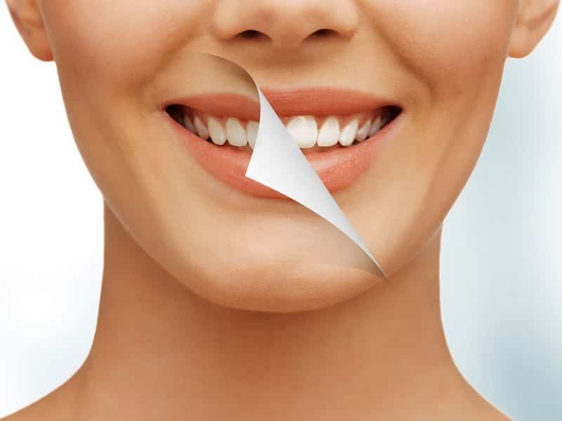 How Not To Kill Your Teeth With Home Whitening|Beauty>Teeth Beauty